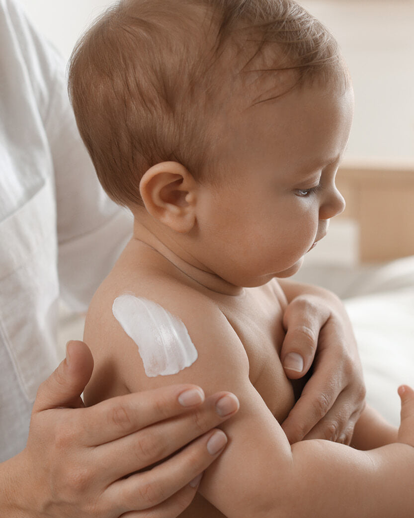 Baby with a white patch on its shoulder, held by an adult.