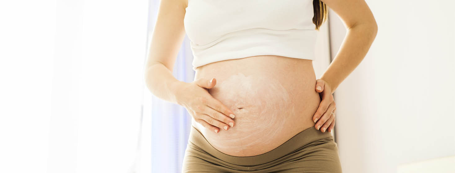 How to get rid Stretch Marks after pregnancy