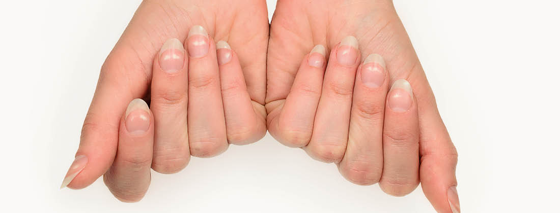 White Spots on Your Nails? Think Zinc Deficiency - HealthPost NZ