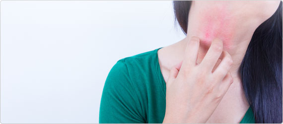 Eczema Causes and Treatment