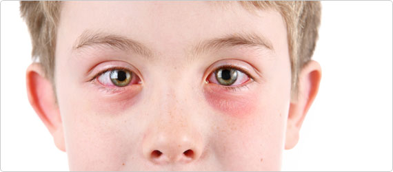 hayfever-banner Get ready to spring into hay fever season